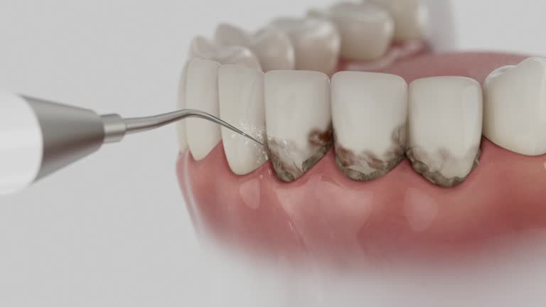 Trusted Dental Crowns And Bridges service in Lagrange, IN - Dentist Open Now